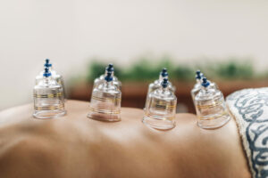 Comprehensive Hijama Cupping Therapy Training Diploma