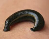 Leech Therapy Training Diploma